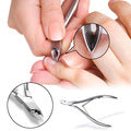 Blackhead and pimple extractor kit - yurionline